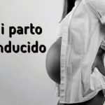 parto inducido experiencia