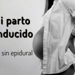 parto inducido sin epidural