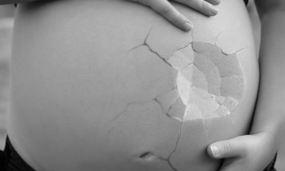 embarazo no evolutivo, causas, sintomas y diagnostico